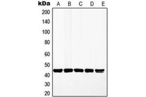 Western blot analysis of MKK1 expression in HeLa (A), A549 (B), MCF7 (C), HepG2 (D), PC12 (E) whole cell lysates. (MEK1 抗体  (Center))