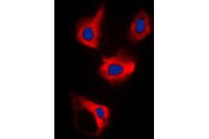 Immunofluorescent analysis of CDCA3 staining in MCF7 cells. (CDCA3 抗体  (C-Term))