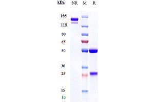 Anti-CSF1R / M-CSFR / CD115 Reference Antibody (cabiralizumab) on SDS-PAGE under reducing (R) condition. (Recombinant CSF1R (Cabiralizumab Biosimilar) 抗体)