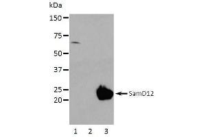 Western Blotting (WB) image for anti-Sterile alpha Motif Domain Containing 12 (SAMD12) (full length) antibody (ABIN2443898) (SAMD12 抗体  (full length))