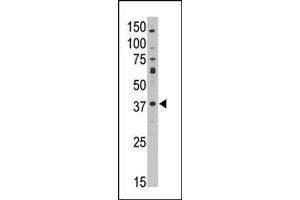 The anti-GEA10 C-term Antibody (ABIN390102 and ABIN2840614) is used in Western blot to detect GEA10 in HL60 lysate. (MAGEA10 抗体  (C-Term))