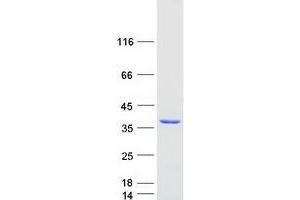 Western Blotting (WB) image for 3-hydroxyanthranilate 3,4-Dioxygenase (HAAO) protein (Myc-DYKDDDDK Tag) (ABIN2722396)