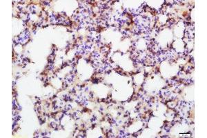 Paraformaldehyde-fixed, paraffin embedded rat lung, Antigen retrieval by boiling in sodium citrate buffer (pH6. (SMAD7 抗体  (AA 1-100))