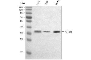 Western blot analysis of SOX2 using anti-SOX2 antibody (ABIN7600382).