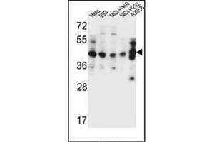 Western blot analysis of GTF2H2C Antibody (C-term) in Hela, 293, NCI-H460, NCI-H292, A2058 cell line lysates (35ug/lane). (GTF2H2C 抗体  (C-Term))