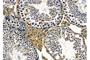 ABIN6263526 and ABIN6279596 at 1/100 staining mouse testis tissue by IHC-P. (NBPF3 抗体  (Internal Region))