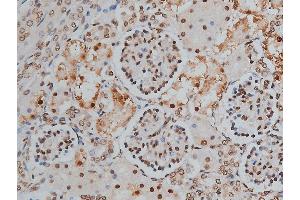 ABIN6255746 and ABIN6268991 at 1/200 staining human kidney tissue sections by IHC-P. (PPP1R12A 抗体  (pThr853))