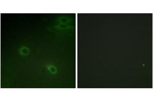 Immunofluorescence (IF) image for anti-Chemokine (C-X-C Motif) Receptor 4 (CXCR4) (AA 303-352), (pSer339) antibody (ABIN1531564)