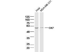 Lane 1: Hela lysates Lane 2: MDA-MB-231 lysates probed with CK7 Polyclonal Antibody, Unconjugated  at 1:300 dilution and 4˚C overnight incubation. (Cytokeratin 7 抗体)