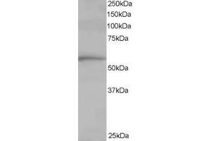ABIN185185 staining (1 ug/ml) of Human Lung lysate (RIPA buffer, 35 ug total protein per lane). (TCP1 alpha/CCTA 抗体  (C-Term))