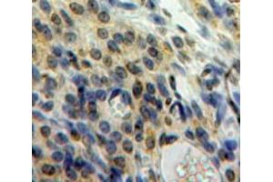 Used in DAB staining on fromalin fixed paraffin-embedded Ovary tissue (HMGN1 抗体  (AA 14-100))