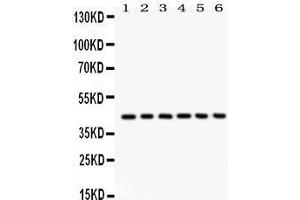 Western Blotting (WB) image for anti-Selectin L (SELL) (AA 39-372) antibody (ABIN3043326)