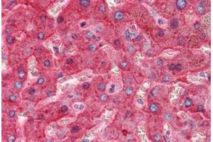 Liver: Formalin-Fixed, Paraffin-Embedded (FFPE)