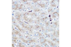 Immunohistochemistry of paraffin-embedded human liver using Heme Oxygenase 1 (HO-1/HMOX1) Rabbit pAb (ABIN3021906, ABIN3021907, ABIN3021908 and ABIN6217466) at dilution of 1:100 (40x lens). (HMOX1 抗体  (AA 1-288))