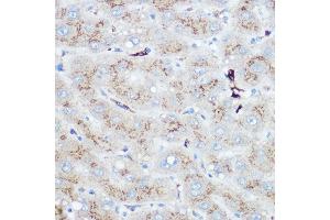 Immunohistochemistry of paraffin-embedded human liver using Heme Oxygenase 1 (HO-1/HMOX1) Rabbit pAb (ABIN3021906, ABIN3021907, ABIN3021908 and ABIN6217466) at dilution of 1:100 (40x lens). (HMOX1 抗体  (AA 1-288))