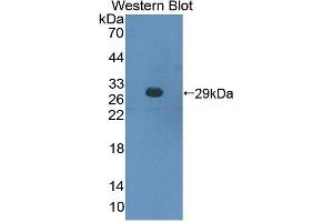 Detection of Recombinant CBFb, Mouse using Polyclonal Antibody to Core Binding Factor Beta Subunit (CBFb)