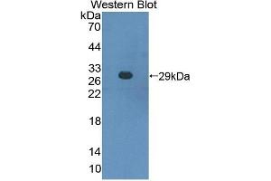 Detection of Recombinant CBFb, Mouse using Polyclonal Antibody to Core Binding Factor Beta Subunit (CBFb) (CBFB 抗体  (AA 1-187))