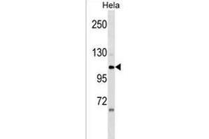 ZNF33A Antibody (N-term) (ABIN1539574 and ABIN2849907) western blot analysis in Hela cell line lysates (35 μg/lane). (ZNF33A 抗体  (N-Term))