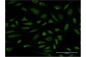 Immunofluorescence (IF) image for anti-PIH1 Domain Containing 1 (PIH1D1) (AA 1-290) antibody (ABIN565799)
