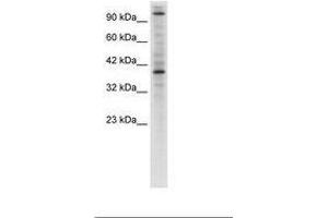 Image no. 1 for anti-Zinc Finger Protein 624 (ZNF624) (AA 499-548) antibody (ABIN6735933) (ZNF624 抗体  (AA 499-548))