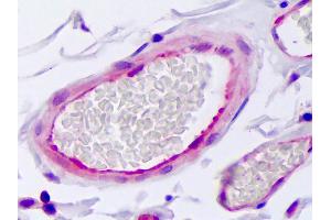 Anti-SERPINE1 / PAI-1 antibody IHC of human vascular endothelium. (PAI1 抗体)