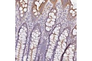 Immunohistochemical staining of human colon with CAMSAP3 polyclonal antibody  shows moderate cytoplasmic positivity in glandular cells at 1:50-1:200 dilution.