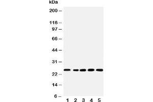Western blot testing of SNRPN antibody and Lane 1:  rat kidney;  2: human U87;  3: (h) HeLa;  4: (h) HMY;  5: (m) NEUR cell lysate (SNRPN 抗体  (N-Term))