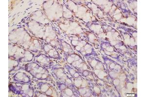Formalin-fixed and paraffin embedded rat colon labeled with Anti-phospho-IRAK4(Thr345)Polyclonal Antibody, Unconjugated (ABIN753538) at 1:200 followed by conjugation to the secondary antibody and DAB staining (IRAK4 抗体  (pThr345))