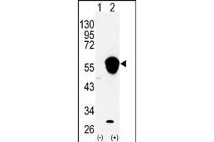 Western blot analysis of ALDH3A1 (arrow) using rabbit polyclonal ALDH3A1 Antibody (N-term) (ABIN392318 and ABIN2841969). (ALDH3A1 抗体  (N-Term))