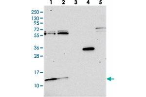 Western blot analysis of Lane 1: RT-4, Lane 2: U-251 MG, Lane 3: Human Plasma, Lane 4: Liver, Lane 5: Tonsil with MRP63 polyclonal antibody . (MRP63 抗体)