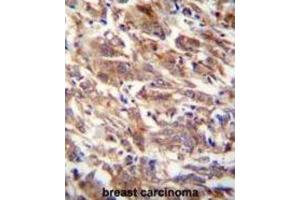 Immunohistochemistry (IHC) image for anti-F-Box and WD Repeat Domain Containing 12 (FBXW12) antibody (ABIN2995589) (FBXW12 抗体)