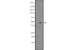 Western blot analysis of TUBD1 expression in Delta 1 Tubulin transfected 293T cell lysate,The lane on the left is treated with the antigen-specific peptide. (TUBD1 抗体  (Internal Region))