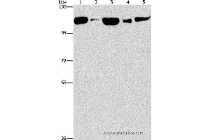 Western blot analysis of Raji cell and human fetal liver tissue, NIH/3T3 cell and mouse brain tissue, hela cell, using DNM2 Polyclonal Antibody at dilution of 1:400 (DNM2 抗体)