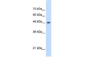 WB Suggested Anti-SMARCE1 Antibody Titration:  0.
