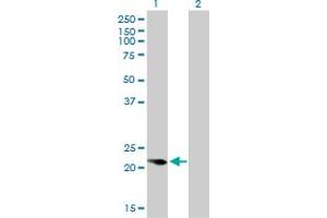Western Blot analysis of CAPS expression in transfected 293T cell line by CAPS monoclonal antibody (M01), clone 4C6. (Calcyphosine 抗体  (AA 1-109))