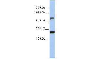 Human HeLa; WB Suggested Anti-ZSCAN20 Antibody Titration: 0. (ZSCAN20 抗体  (Middle Region))