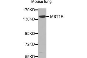 Western blot analysis of extracts of mouse lung, using MST1R antibody (ABIN5970218). (MST1R 抗体)