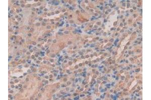 IHC-P analysis of Mouse Kidney Tissue, with DAB staining. (Peroxiredoxin 2 抗体  (AA 6-164))