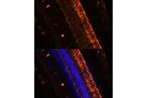 Immunofluorescence analysis of mouse eye using KCNS2 Polyclonal Antibody (ABIN7269478) at dilution of 1:100 (20x lens). (KCNS2 抗体  (AA 1-187))