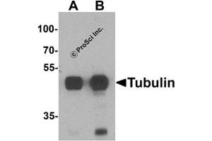 Western Blotting (WB) image for anti-alpha Tubulin (TUBA1) (N-Term) antibody (ABIN1077421) (alpha Tubulin 抗体  (N-Term))
