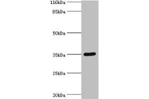 Western blot All lanes: SULT1B1 antibody at 24 μg/mL + Mouse small intestine tissue Secondary Goat polyclonal to rabbit IgG at 1/10000 dilution Predicted band size: 35 kDa Observed band size: 35 kDa (SULT1B1 抗体  (AA 1-271))