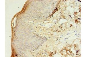 Immunohistochemistry of paraffin-embedded human skin tissue using ABIN7171883 at dilution of 1:100 (Tetraspanin 6 抗体  (AA 115-208))