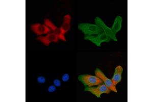 ABIN6260012 and ABIN6279137 staining HepG2 cells by IF/ICC. (AQP6 抗体  (Internal Region))