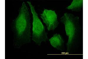 Immunofluorescence of monoclonal antibody to CAMK2B on HeLa cell. (CAMK2B 抗体  (AA 405-502))