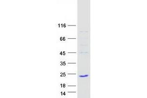 Validation with Western Blot