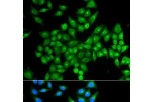 Immunofluorescence analysis of MCF-7 cells using DAO Polyclonal Antibody (D Amino Acid Oxidase 抗体)