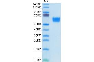 Human IL-1R1 on Tris-Bis PAGE under reduced condition. (IL1R1 Protein (AA 18-332) (His tag))