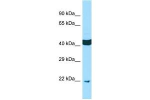 WB Suggested Anti-SCAMP4 Antibody Titration: 1. (SCAMP4 抗体  (N-Term))