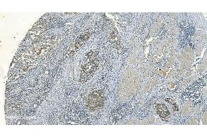 IHC analysis of IDH2 using anti-IDH2 antibody (ABIN7602786).