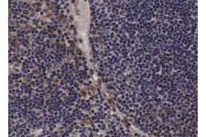 ABIN6267240 at 1/200 staining human lymph node tissue sections by IHC-P.